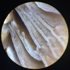 Gills of Agaricus Bisporus (Mag: 20x*)